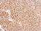 Exosome complex exonuclease RRP40 antibody, PA5-30610, Invitrogen Antibodies, Immunohistochemistry paraffin image 
