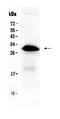 Insulin Like Growth Factor Binding Protein 1 antibody, PA5-79446, Invitrogen Antibodies, Western Blot image 
