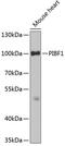 Progesterone Immunomodulatory Binding Factor 1 antibody, GTX33409, GeneTex, Western Blot image 