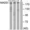 MAP Kinase Activating Death Domain antibody, A02030, Boster Biological Technology, Western Blot image 