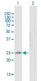 Gap Junction Protein Beta 4 antibody, H00127534-B01P, Novus Biologicals, Western Blot image 