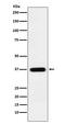 Transmembrane Protein 173 antibody, M01871, Boster Biological Technology, Western Blot image 