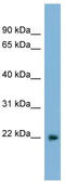 Ladybird Homeobox 2 antibody, TA342400, Origene, Western Blot image 