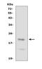 Fibroblast Growth Factor 21 antibody, PA1673, Boster Biological Technology, Western Blot image 