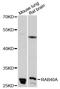 RAB40A, Member RAS Oncogene Family antibody, LS-C748297, Lifespan Biosciences, Western Blot image 