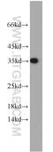 Protein Kinase CAMP-Activated Catalytic Subunit Beta antibody, 55382-1-AP, Proteintech Group, Western Blot image 