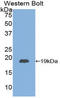 Thyroid Stimulating Hormone Subunit Beta antibody, LS-C304683, Lifespan Biosciences, Western Blot image 