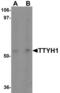 Tweety Family Member 1 antibody, LS-C153708, Lifespan Biosciences, Western Blot image 