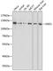 Staphylococcal Nuclease And Tudor Domain Containing 1 antibody, 14-976, ProSci, Western Blot image 