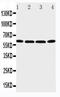 Purinergic Receptor P2X 6 antibody, LS-C313510, Lifespan Biosciences, Western Blot image 
