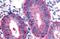 Dickkopf WNT Signaling Pathway Inhibitor 1 antibody, GTX40056, GeneTex, Immunohistochemistry paraffin image 