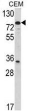 Transglutaminase 4 antibody, GTX81652, GeneTex, Western Blot image 