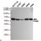 Pyruvate Kinase M1/2 antibody, LS-C813084, Lifespan Biosciences, Western Blot image 