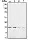 Casein Kinase 2 Beta antibody, LS-C352062, Lifespan Biosciences, Western Blot image 