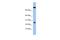 Zinc Finger SWIM-Type Containing 3 antibody, A18082, Boster Biological Technology, Western Blot image 