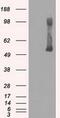 Glucokinase antibody, GTX84440, GeneTex, Western Blot image 