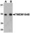 Transmembrane Protein 184B antibody, TA306958, Origene, Western Blot image 