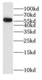 Glycerol Kinase 5 antibody, FNab03471, FineTest, Western Blot image 