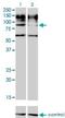 Interleukin-31 receptor subunit alpha antibody, H00133396-M01, Novus Biologicals, Western Blot image 