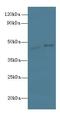 PTGES3L-AARSD1 Readthrough antibody, LS-C379330, Lifespan Biosciences, Western Blot image 