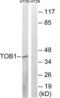 Transducer Of ERBB2, 1 antibody, LS-C199672, Lifespan Biosciences, Western Blot image 