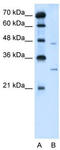 Solute Carrier Family 36 Member 3 antibody, TA334623, Origene, Western Blot image 