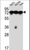 Heat Shock Protein Family A (Hsp70) Member 5 antibody, LS-C165063, Lifespan Biosciences, Western Blot image 