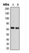 Checkpoint Kinase 2 antibody, orb393245, Biorbyt, Western Blot image 