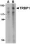 TAR (HIV-1) RNA Binding Protein 1 antibody, A09397, Boster Biological Technology, Western Blot image 