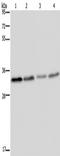 Toll Like Receptor Adaptor Molecule 2 antibody, TA350074, Origene, Western Blot image 