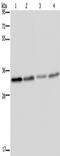 Toll Like Receptor Adaptor Molecule 2 antibody, TA350074, Origene, Western Blot image 