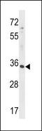 RFNG O-Fucosylpeptide 3-Beta-N-Acetylglucosaminyltransferase antibody, PA5-48774, Invitrogen Antibodies, Western Blot image 