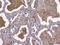 Beta-2-Microglobulin antibody, M00456-2, Boster Biological Technology, Immunohistochemistry paraffin image 