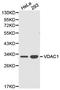Voltage Dependent Anion Channel 1 antibody, LS-C192929, Lifespan Biosciences, Western Blot image 