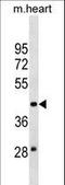 Molybdenum Cofactor Synthesis 3 antibody, LS-C158160, Lifespan Biosciences, Western Blot image 