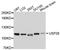 Ubiquitin Specific Peptidase 28 antibody, A10400, ABclonal Technology, Western Blot image 