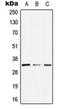 General transcription factor IIE subunit 2 antibody, orb214024, Biorbyt, Western Blot image 