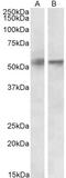 Serine/Threonine Kinase 38 antibody, 42-419, ProSci, Western Blot image 