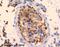 Succinate Dehydrogenase Complex Flavoprotein Subunit A antibody, ab14715, Abcam, Immunohistochemistry paraffin image 