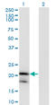 Interleukin 1 Receptor Antagonist antibody, LS-C139122, Lifespan Biosciences, Western Blot image 