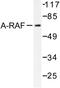 A-Raf Proto-Oncogene, Serine/Threonine Kinase antibody, LS-C176384, Lifespan Biosciences, Western Blot image 