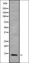 Nuclear Factor, Erythroid 2 antibody, orb335405, Biorbyt, Western Blot image 