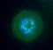 Aurora Kinase B antibody, NB100-294, Novus Biologicals, Immunocytochemistry image 