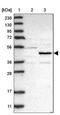 NOP2/Sun RNA Methyltransferase 5 antibody, NBP1-89416, Novus Biologicals, Western Blot image 