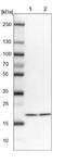 Ubiquitin Conjugating Enzyme E2 L3 antibody, NBP1-92557, Novus Biologicals, Western Blot image 