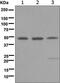 Meis Homeobox 1 antibody, ab124686, Abcam, Western Blot image 