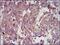 Insulin Like Growth Factor 2 antibody, MA5-17096, Invitrogen Antibodies, Immunohistochemistry paraffin image 