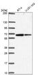 Solute Carrier Family 30 Member 6 antibody, NBP2-31673, Novus Biologicals, Western Blot image 