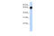 Diacylglycerol Kinase Epsilon antibody, 26-054, ProSci, Enzyme Linked Immunosorbent Assay image 