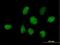 Zinc Finger Protein 486 antibody, H00090649-B01P, Novus Biologicals, Immunocytochemistry image 